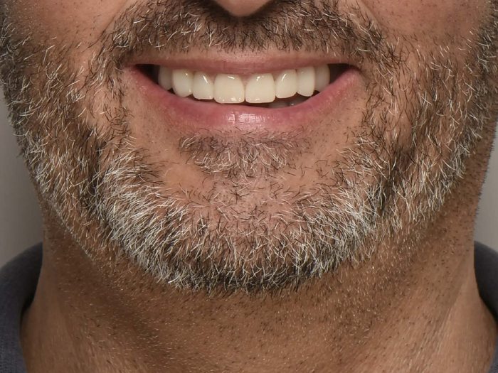 Dopo