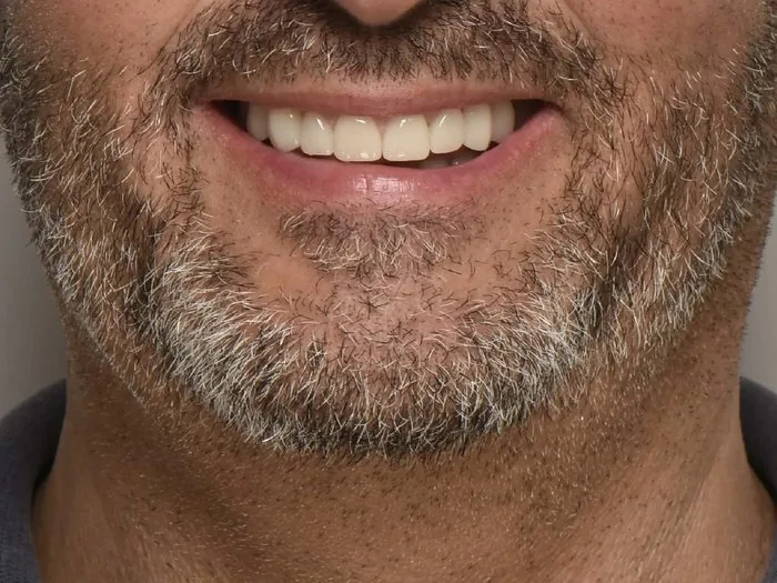 Dopo